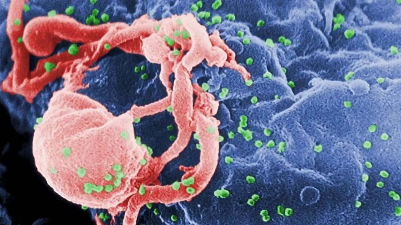 Bệnh nhân Na Uy khỏi cả HIV lẫn ung thư nhờ gene hiếm của anh trai