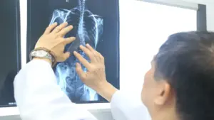 Nhiều trẻ vẹo cột sống nặng mới đi khám, chuyên gia cảnh báo nguy cơ biến chứng nặng