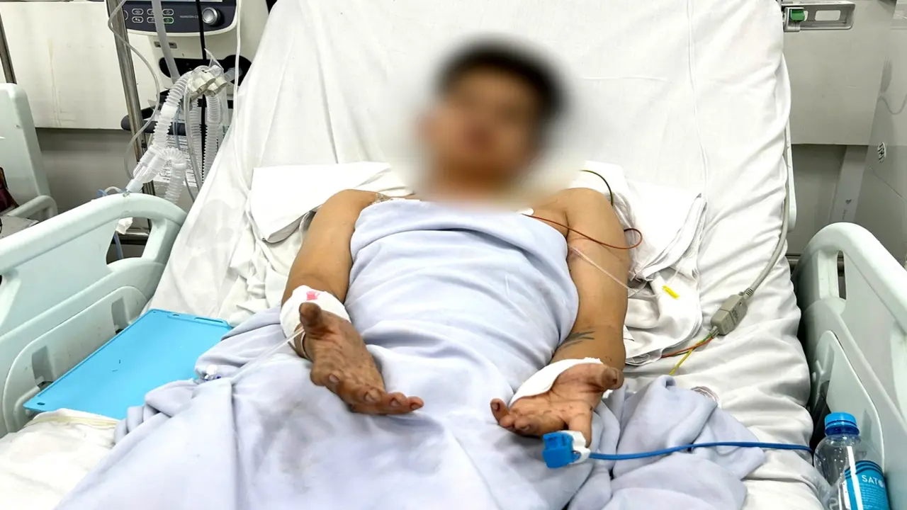 Vụ cháy nhà trọ ở TP.HCM, 2 người tử vong: Nhiều nạn nhân tiên lượng bệnh nặng hồi phục ngoạn mục