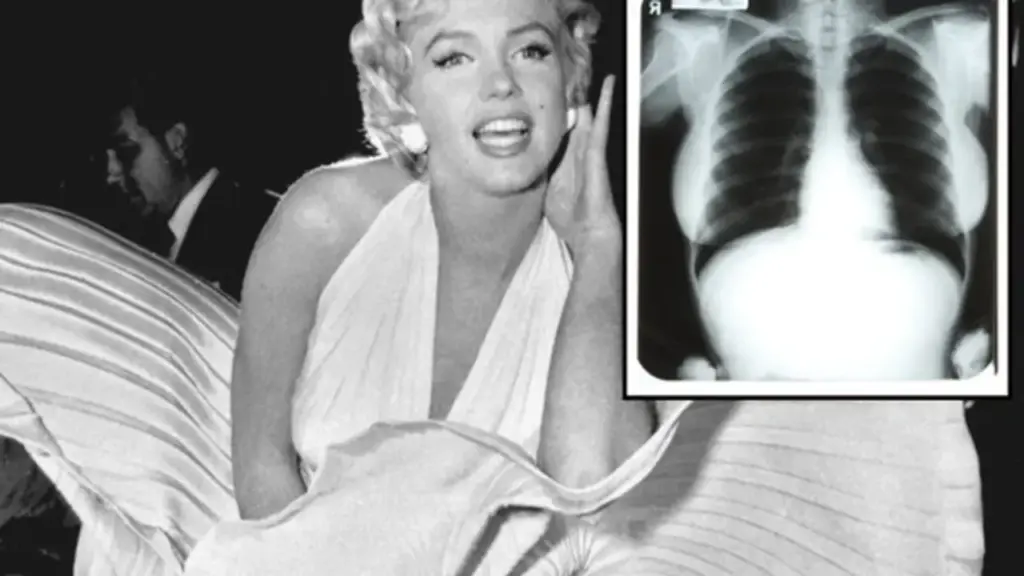Ảnh X-quang của Marilyn Monroe gây phẫn nộ khi bị đấu giá