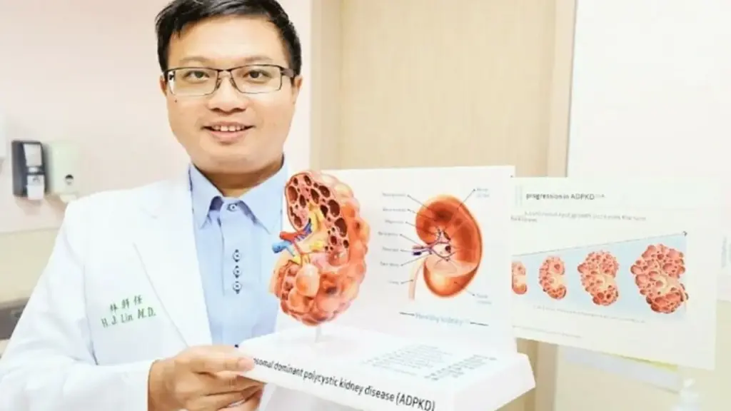 Bác sĩ cảnh báo nguy cơ suy thận nghiêm trọng từ chứng cao huyết áp