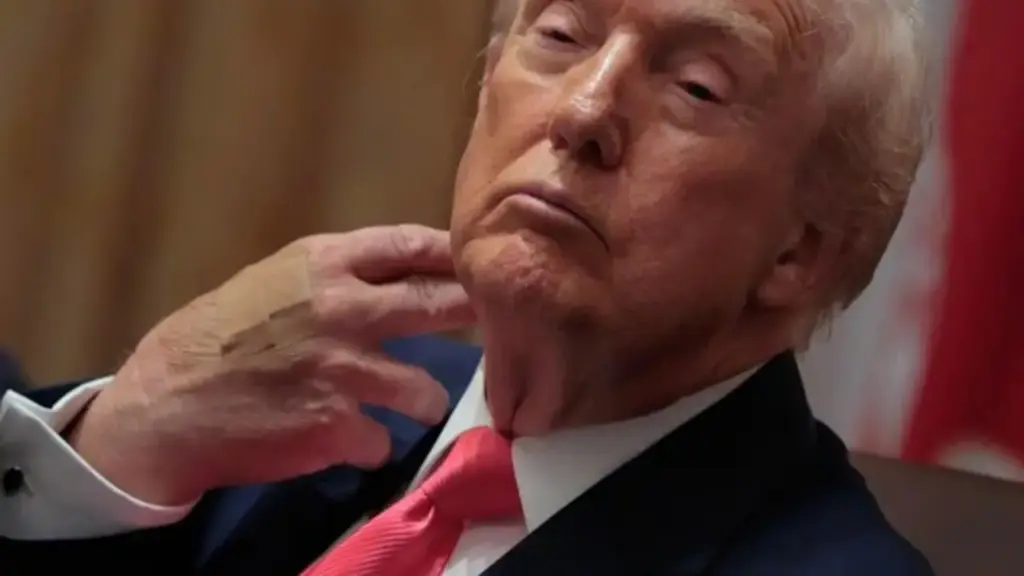 Bác sĩ của ông Trump nói gì sau đợt kiểm tra sức khỏe?