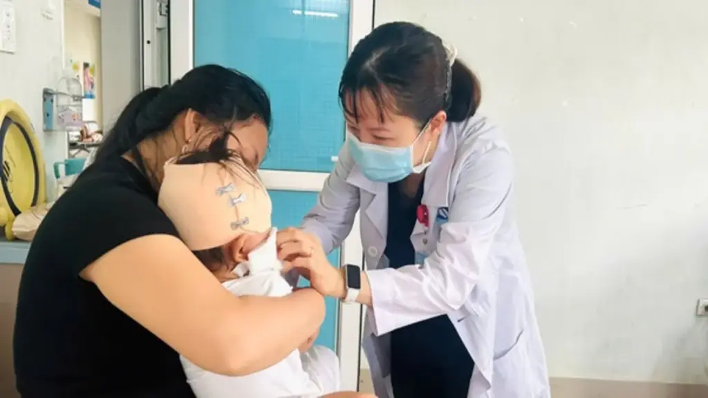Bé trai 19 tháng tuổi bị chó cắn rách sâu vùng đầu, má