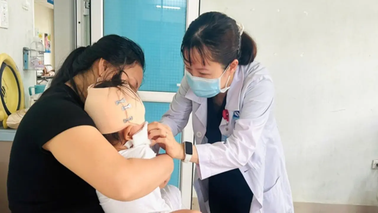 Bé trai 19 tháng tuổi bị chó cắn rách sâu vùng đầu, má