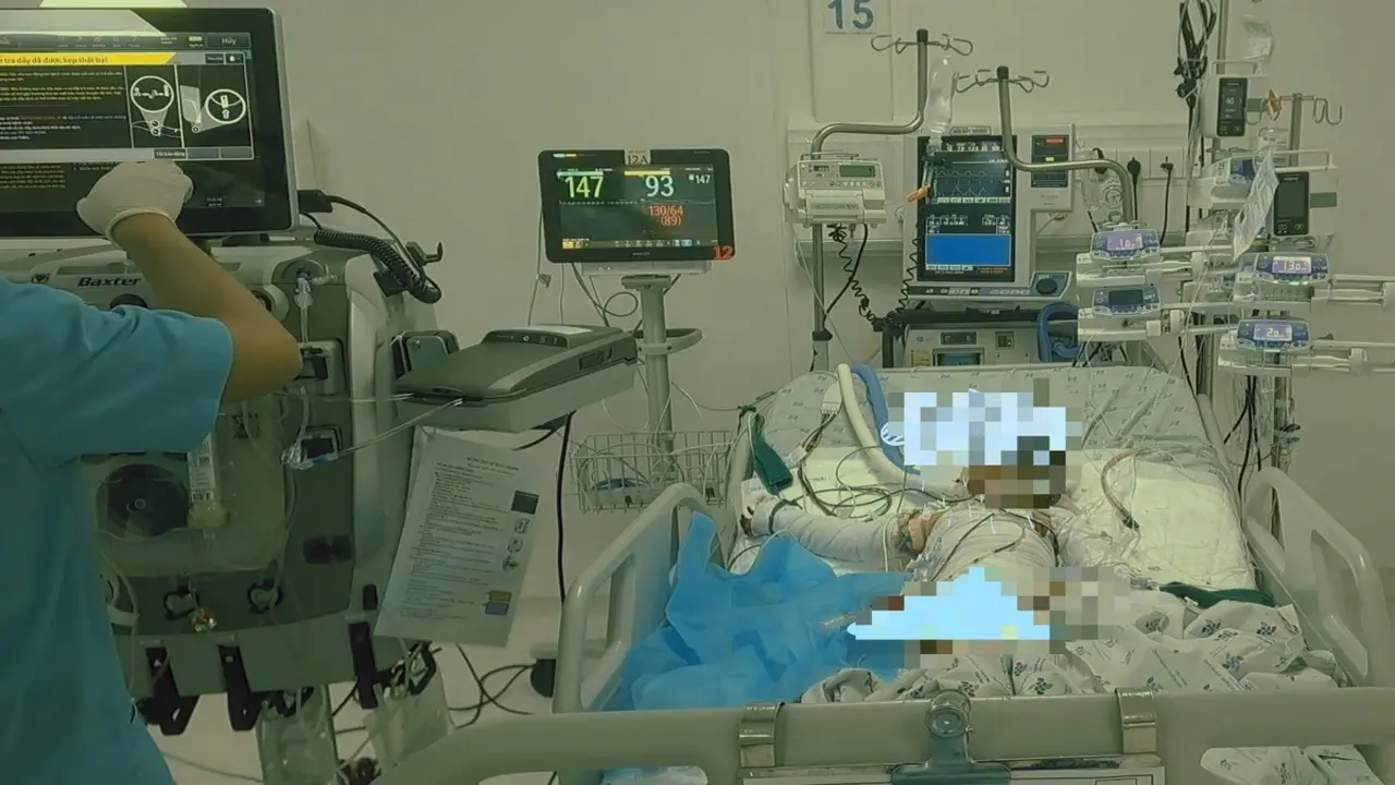 Bé trai 4 tuổi bỏng 90% cơ thể sau vụ cháy nhà thương tâm