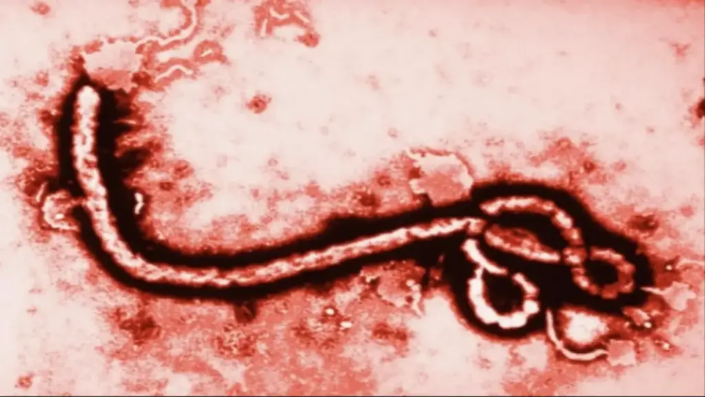 Bệnh Ebola