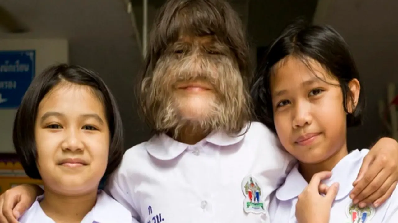 "Cô bé người sói" và hành trình phía sau khiến nhiều người nghẹn lòng