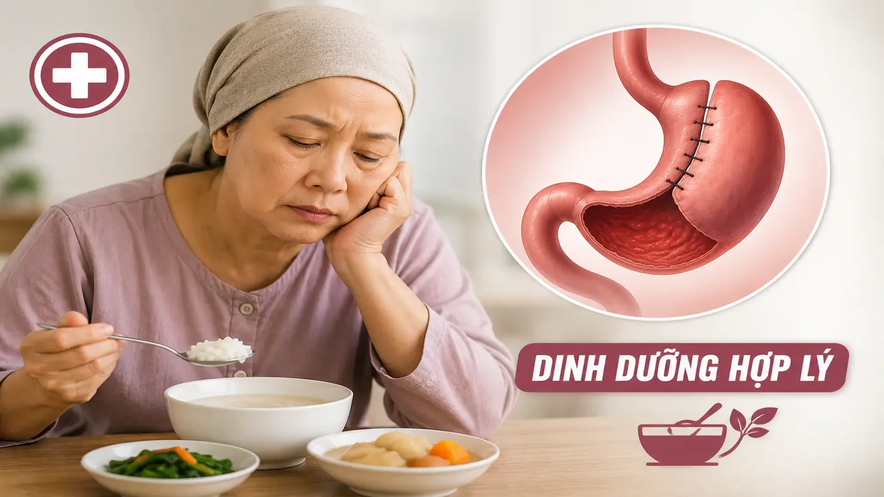 Mệt mỏi, sụt cân sau điều trị ung thư: Khi nào đáng lo?