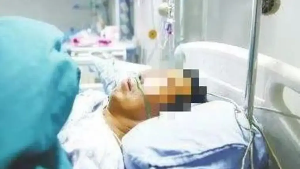 Người đàn ông 53 tuổi đột ngột bị liệt vào buổi sáng, bác sĩ chỉ rõ "sai lầm chí mạng"