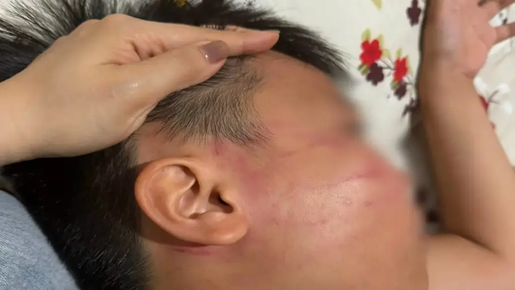 Thông tin mới vụ nam sinh 9 tuổi nghi bị giáo viên dạy thêm đánh