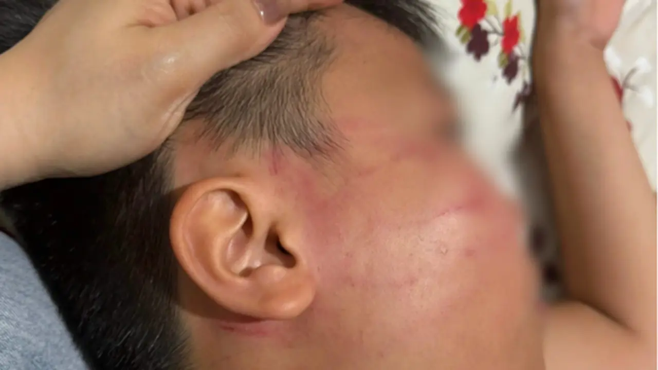 Vụ nam sinh lớp 4 bị giáo viên đánh bầm mặt: Bất ngờ phát hiện lớp dạy thêm tiếng Anh “chui”