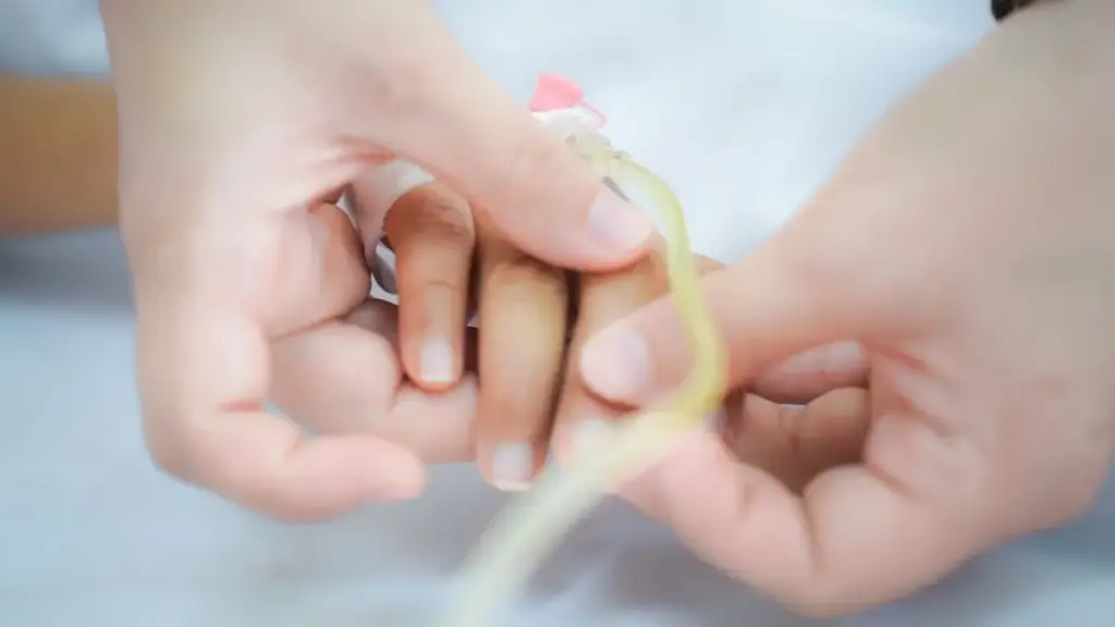 Bé 10 tuổi tổn thương thân não do tay chân miệng