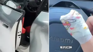 Chủ xe Xiaomi bị cửa kẹp gãy tay, hãng đền bằng điểm ứng dụng