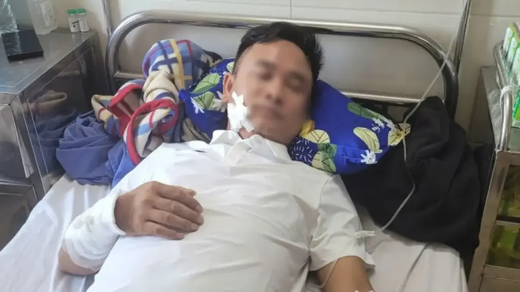 Điều tra vụ người đàn ông bị nhóm người đi ô tô nổ súng bắn trọng thương