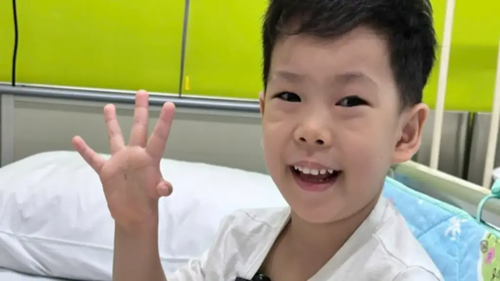 Hành trình 4 năm rưỡi tìm lại bàn tay trọn vẹn cho cậu bé có "ngón tay rơi"