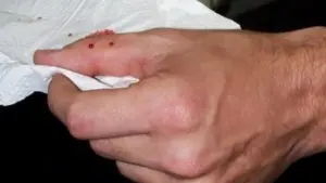 Mở khóa xe máy, người đàn ông bị rắn độc dài hơn 1m lao ra cắn vào tay