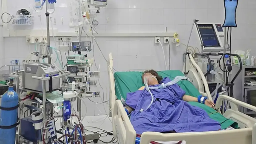 Người phụ nữ 43 tuổi nguy kịch sau 5 ngày ho, sốt