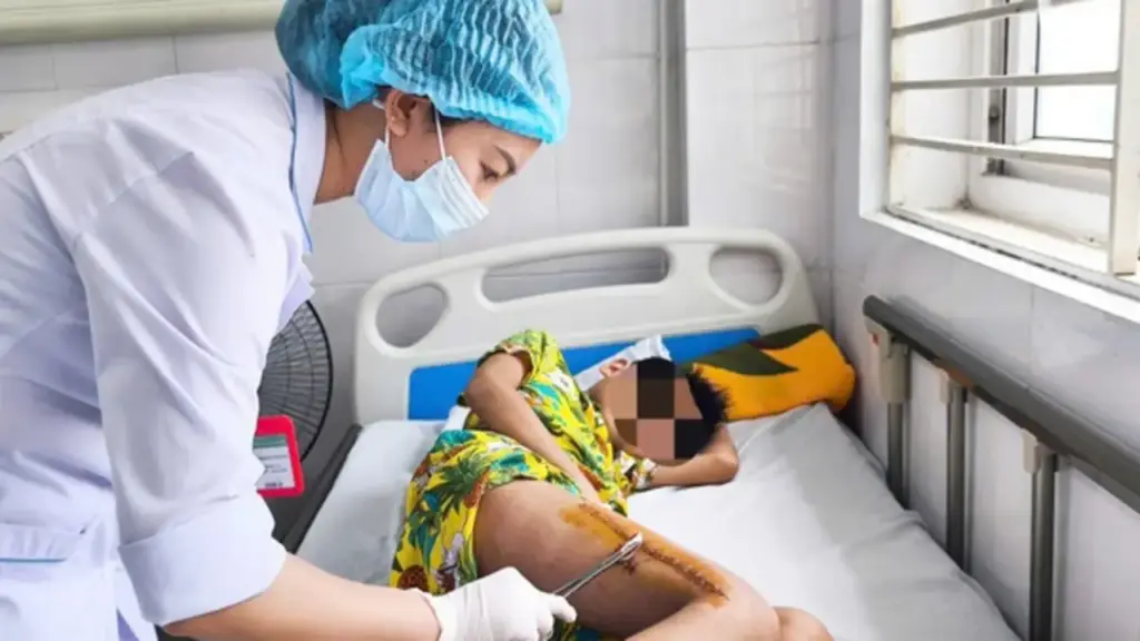 Tưởng đau cơ do vận động, bé trai rơi vào sốc nhiễm khuẩn do tụ cầu vàng