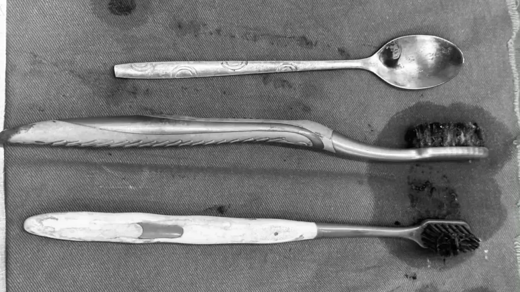 Bác sĩ lấy 2 bàn chải, một thìa inox ra khỏi dạ dày người bệnh