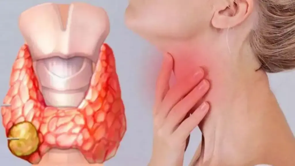 Có những biểu hiện này, đừng chủ quan vì có thể là dấu hiệu ung thư