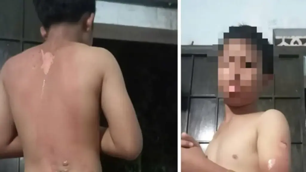 Công an vào cuộc vụ mẹ tạt nước sôi lên người con trai