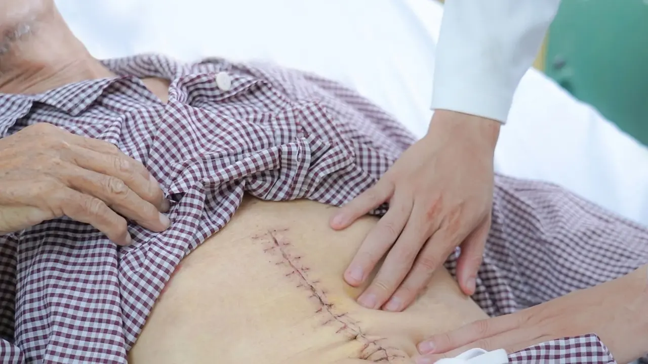 Gỡ 'bom nổ chậm' trong bụng người đàn ông