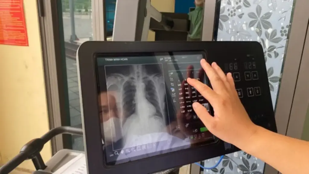 Hà Nội khám sàng lọc miễn phí 12 bệnh mạn tính, ác tính