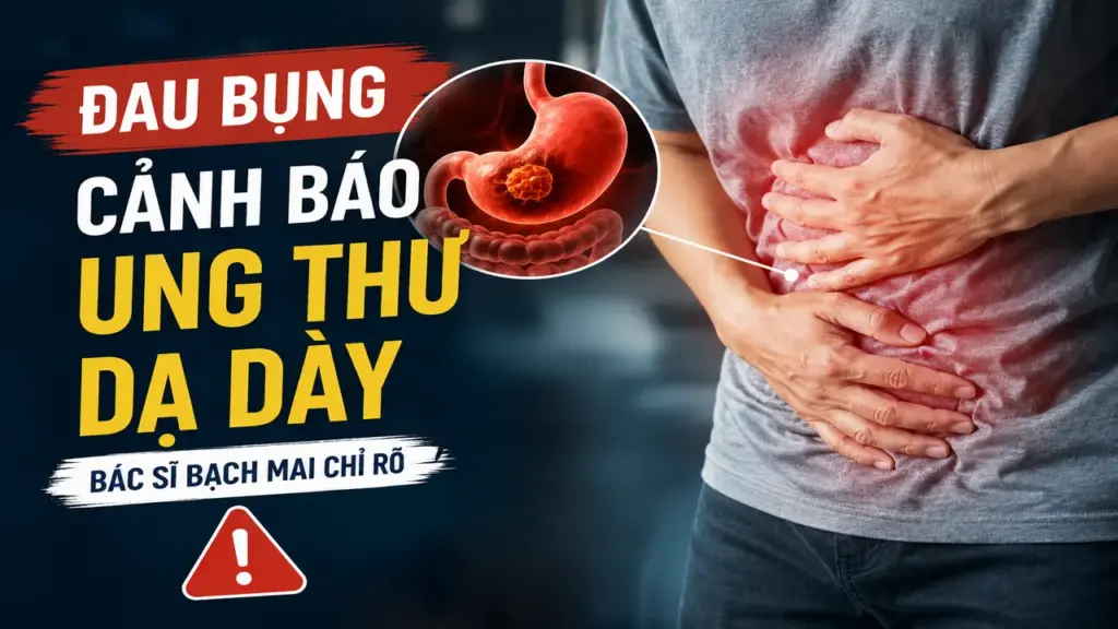 Kiểu đau bụng quen thuộc cảnh báo ung thư dạ dày