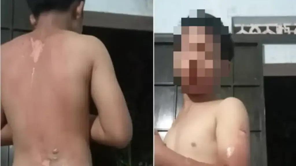 Lan truyền tin bé trai bị mẹ tạt nước sôi gây bỏng ở Đắk Lắk: Công an vào cuộc