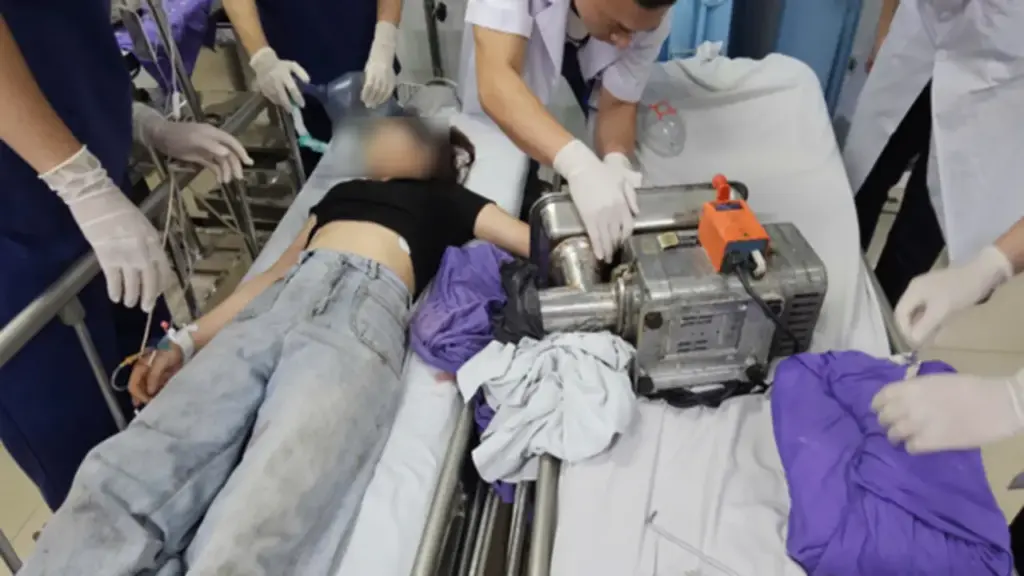 Một phút bất cẩn, cô gái 19 tuổi đối mặt biến cố lớn