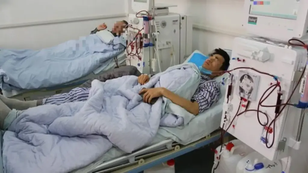 Người đàn ông 39 tuổi suy thận vì "sai lầm chí mạng" khi tắm