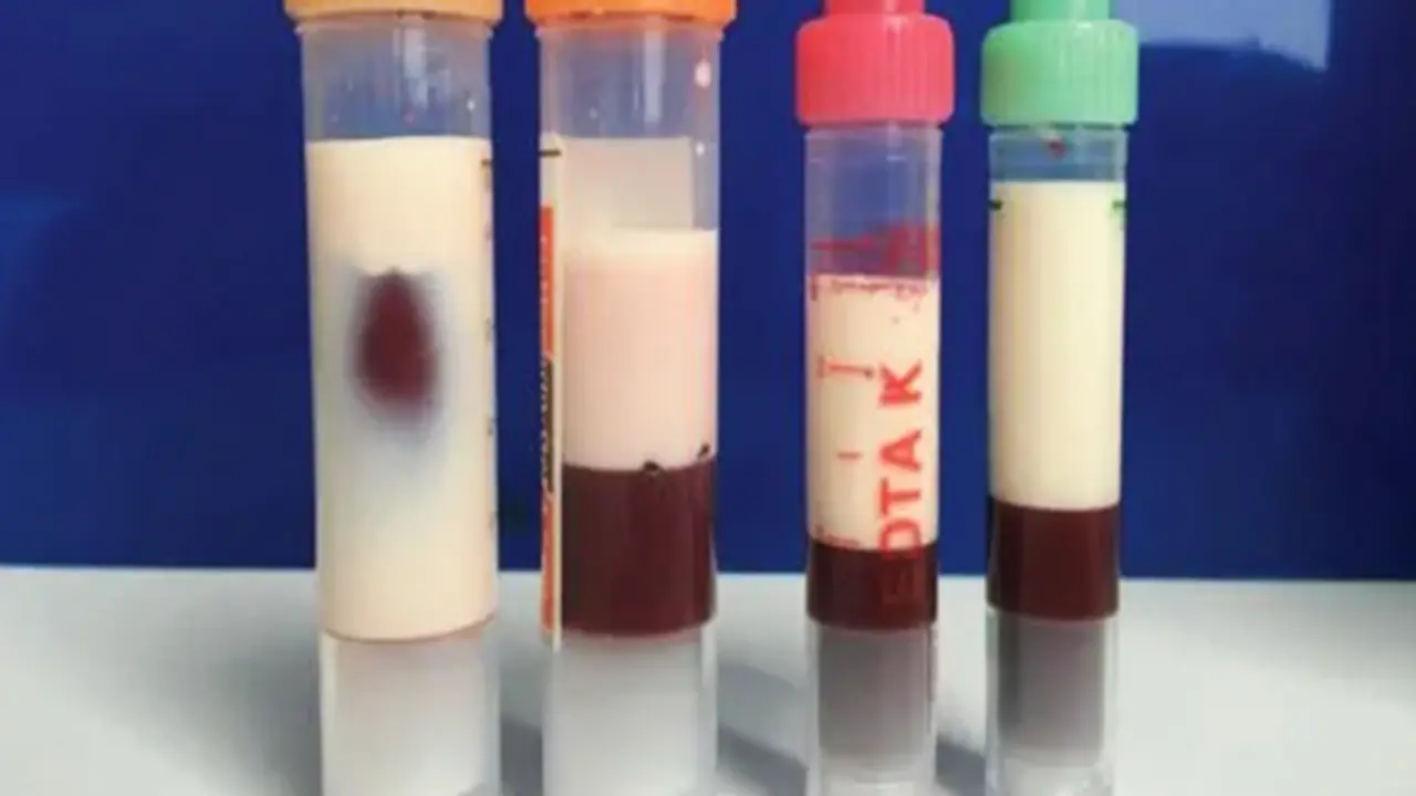 Người phụ nữ 31 tuổi "máu đặc vàng như kem" vì ăn món quen thuộc suốt 4 tháng