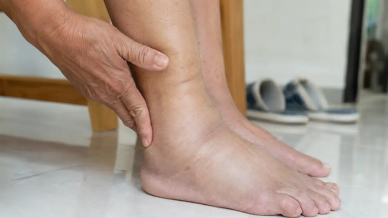 Sưng mắt cá chân vào buổi tối cảnh báo bệnh gì?