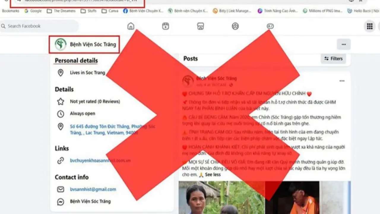 Tài khoản Facebook giả mạo, đăng hình cậu bé bị bỏng 96% để kêu gọi từ thiện