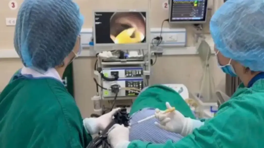 Thường xuyên ăn thịt bò tái, đi khám, người đàn ông phát hiện sán dây bò dài 1,2 mét trong ruột