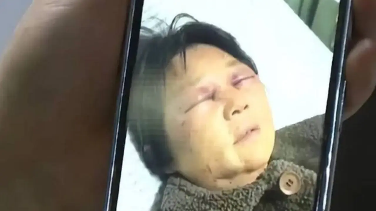 Từ chối chăm cháu, mẹ chồng bị con dâu hành hung đến gãy xương sườn