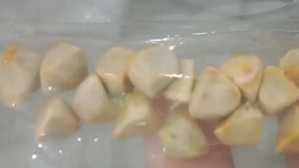 Uống trà đá đều đặn suốt 10 năm, người phụ nữ sốc khi bác sĩ lấy ra thứ "đáng sợ" trong bụng
